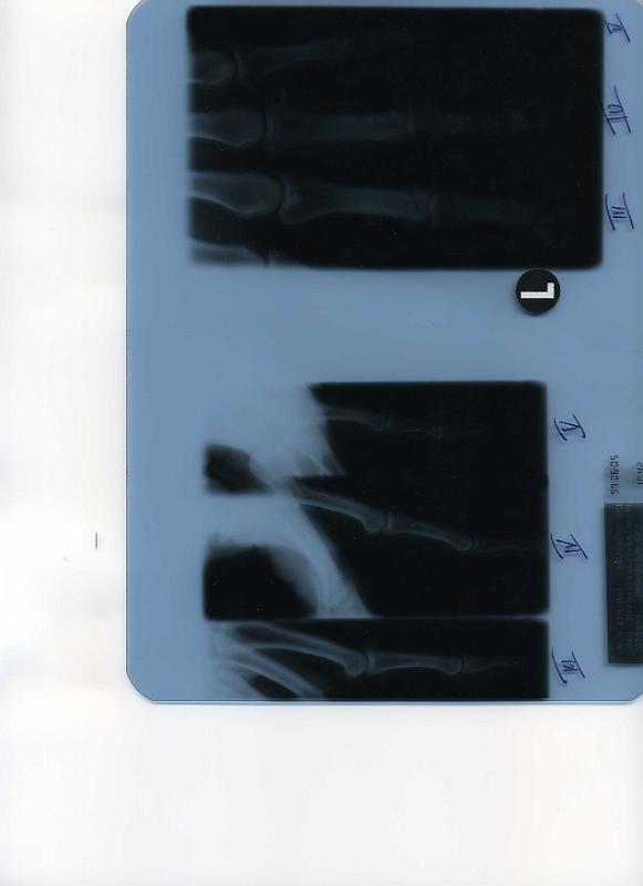 Geoff Broughton's X-rays.jpg